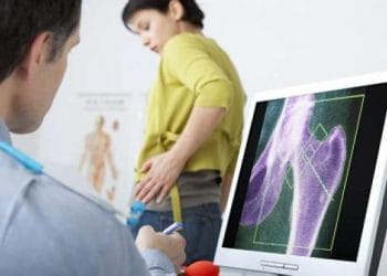Ilustrasi Anak Muda Osteoporosis. (Sumber: jatim.suara.com)