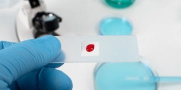 Alpha thalassemia adalah kelainan darah genetik yang sering tak disadari. Kenali gejala dan pentingnya deteksi dini untuk menjaga kesehatan tubuh. Foto: Freepik