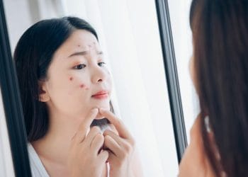 Jarang mencuci wajah bisa sebabkan kulit kusam, jerawat, hingga penuaan dini. Simak penjelasan dokter kulit tentang risiko yang mungkin terjadi. Foto: Freepik