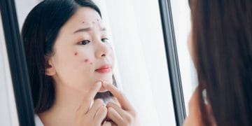 Jarang mencuci wajah bisa sebabkan kulit kusam, jerawat, hingga penuaan dini. Simak penjelasan dokter kulit tentang risiko yang mungkin terjadi. Foto: Freepik