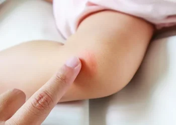 Kulit bayi sensitif mudah iritasi oleh sabun, deterjen, atau bahan kimia. Pelajari cara merawatnya dengan benar dan aman. (Sumber: Halodoc)
