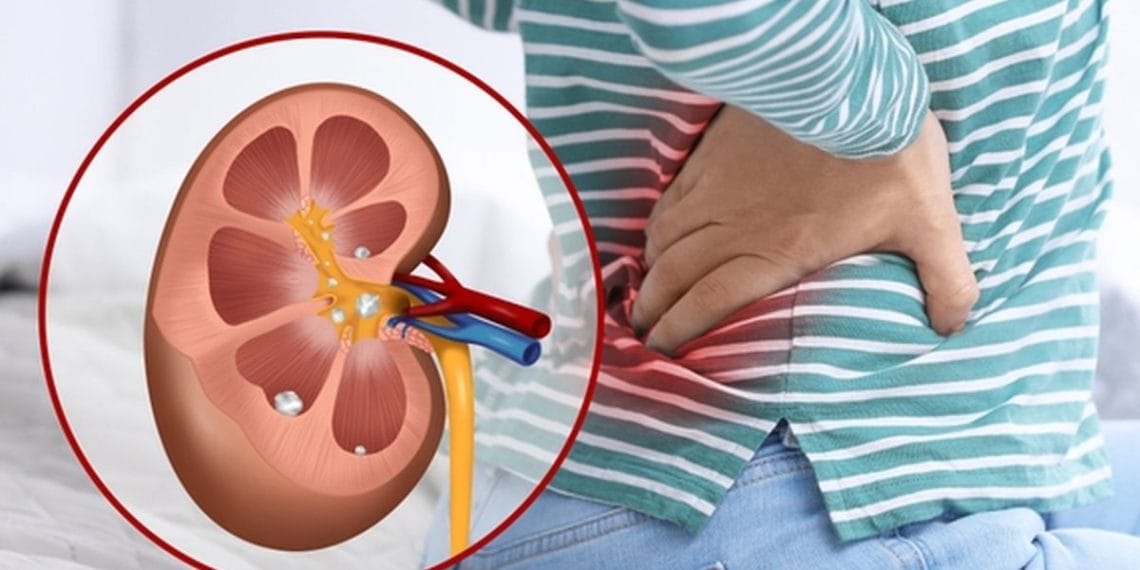 Kaki sering kram bisa menjadi sinyal fungsi ginjal terganggu. Ketahui penyebab, gejala, dan langkah yang bisa dilakukan berdasarkan penjelasan medis. (Sumber: Shutterstock/New Africa)