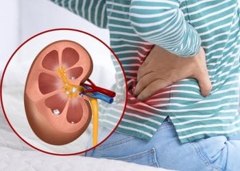 Kaki sering kram bisa menjadi sinyal fungsi ginjal terganggu. Ketahui penyebab, gejala, dan langkah yang bisa dilakukan berdasarkan penjelasan medis. (Sumber: Shutterstock/New Africa)