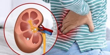 Kaki sering kram bisa menjadi sinyal fungsi ginjal terganggu. Ketahui penyebab, gejala, dan langkah yang bisa dilakukan berdasarkan penjelasan medis. (Sumber: Shutterstock/New Africa)