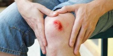 Cara alami menyembuhkan luka tanpa obat kimia. Bahan seperti lidah buaya dan marigold bisa bantu kulit pulih lebih cepat. (Foto: Alodokter)