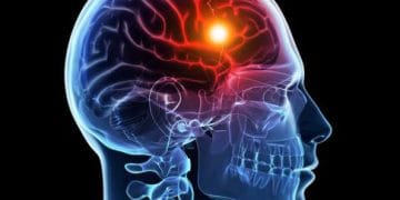 Stroke tak hanya menyerang lansia, tapi juga usia muda. Kenali gejala tersembunyinya agar bisa mencegah risiko kematian dan disabilitas permanen. (Foto: labcito.co.id)