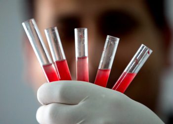 Golongan darah Rh-null, atau “darah emas”, hanya dimiliki oleh < 50 orang di dunia dan sangat dicari untuk transfusi pasien langka. (Foto: Abid Katib/Getty Images)