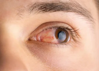 Kenali berbagai ciri mata bermasalah yang sering diabaikan agar bisa mendapat penanganan tepat sebelum kondisinya memburuk. Simak tanda tanda yang perlu diwaspadai. (Foto: jec.co.id)