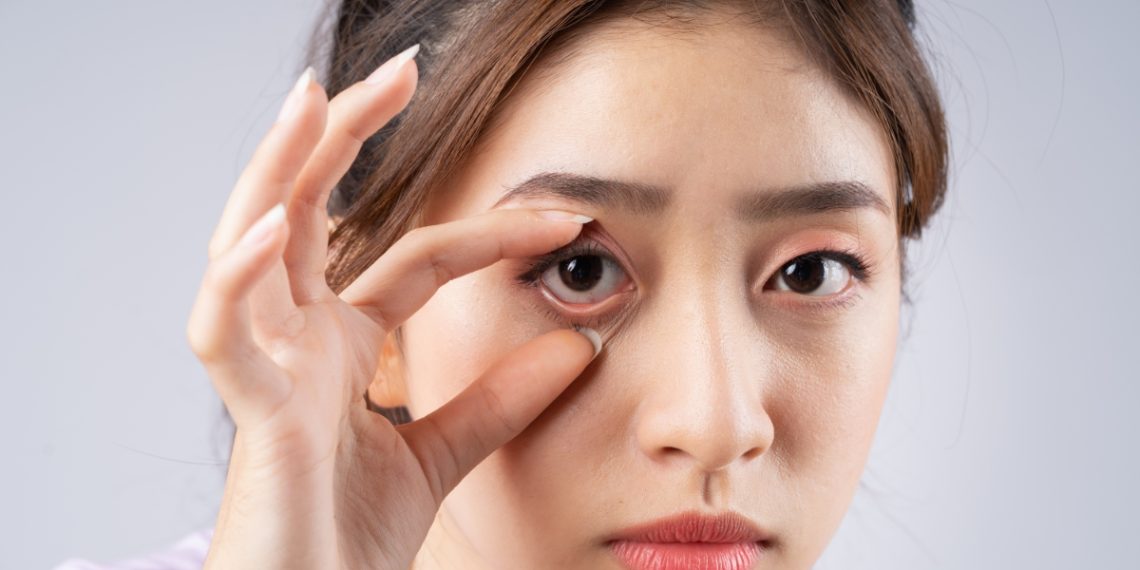 Kenali berbagai tanda mata tidak sehat seperti mata merah, berair, hingga rabun senja. Pelajari penyebabnya dan kapan harus memeriksakan diri ke dokter. (Foto: klikdokter.com)