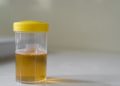 Urine berbusa bisa menjadi tanda protein dalam urine. Kenali penyebab medis dan kapan kondisi ini perlu diperiksakan ke dokter. (Foto: Halodoc)
