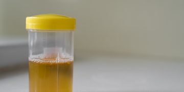 Urine berbusa bisa menjadi tanda protein dalam urine. Kenali penyebab medis dan kapan kondisi ini perlu diperiksakan ke dokter. (Foto: Halodoc)