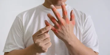 Beberapa makanan favorit ternyata bisa memicu kambuhnya asam urat. Simak daftar dan penjelasan lengkapnya di sini. (Foto: Halodoc)