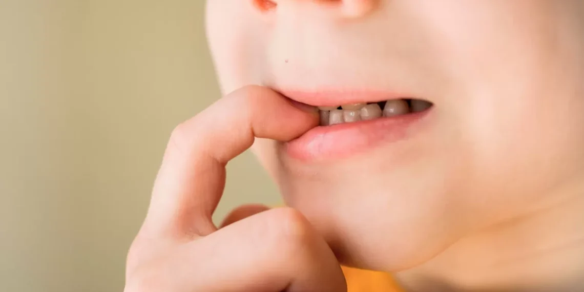 Kebiasaan menggigit kuku bisa jadi tanda stres hingga gangguan kecemasan. Simak penyebab psikologis dan cara menghentikannya. (Foto: Freepik)