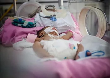 Sekitar 50 ribu anak Indonesia mengalami jantung bawaan, namun hanya 5 ribu yang bisa ditangani. Ini penjelasan Wamenkes. (Foto: Halodoc)