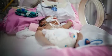 Sekitar 50 ribu anak Indonesia mengalami jantung bawaan, namun hanya 5 ribu yang bisa ditangani. Ini penjelasan Wamenkes. (Foto: Halodoc)