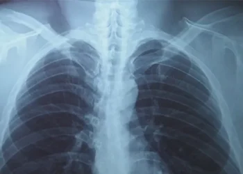 Paru paru basah atau pneumonia bisa menyerang segala usia. Kenali kebiasaan sehari hari yang meningkatkan risiko infeksi paru dan cara mencegahnya. (Foto: Halodoc)