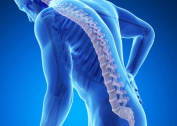 Osteoporosis sering tanpa gejala. Kenali tanda awalnya seperti tinggi badan menyusut, nyeri punggung, hingga gigi goyang sebelum terlambat. (Foto: mediaindonesia.com)