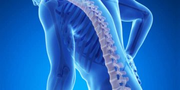 Osteoporosis sering tanpa gejala. Kenali tanda awalnya seperti tinggi badan menyusut, nyeri punggung, hingga gigi goyang sebelum terlambat. (Foto: mediaindonesia.com)