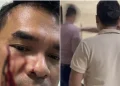 Kronologi pemukulan Waketum PSI Bro Ron di Menteng terungkap. Polisi tangkap pelaku, dua orang jadi tersangka dalam insiden tersebut. (Foto: jawapos.com)