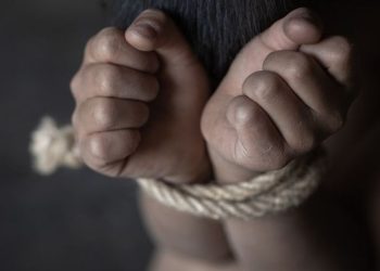 Korban penyekapan dan penganiayaan di Jawa Barat kini menunjukkan perkembangan positif. YTR sudah dapat berkomunikasi meski masih menjalani pemulihan.