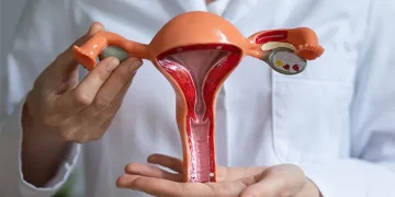 PCOS resmi berganti nama menjadi PMOS. Simak alasan perubahan, gejala, serta dampaknya terhadap kesehatan perempuan.