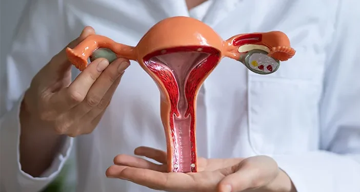 PCOS resmi berganti nama menjadi PMOS. Simak alasan perubahan, gejala, serta dampaknya terhadap kesehatan perempuan.
