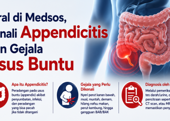 Appendicitis atau radang usus buntu dapat menyebabkan nyeri perut yang memburuk. Kenali gejala, kondisi yang mirip, hingga cara dokter memastikan diagnosis.