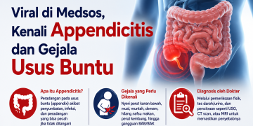 Appendicitis atau radang usus buntu dapat menyebabkan nyeri perut yang memburuk. Kenali gejala, kondisi yang mirip, hingga cara dokter memastikan diagnosis.